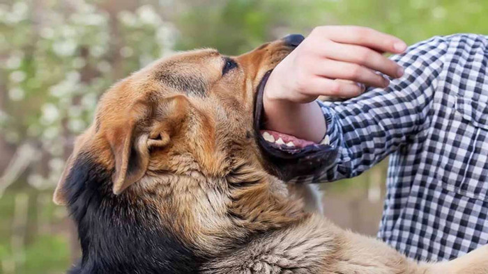 Những điều cần làm sau khi bị chó cắn để ngăn ngừa nguy cơ bệnh dại